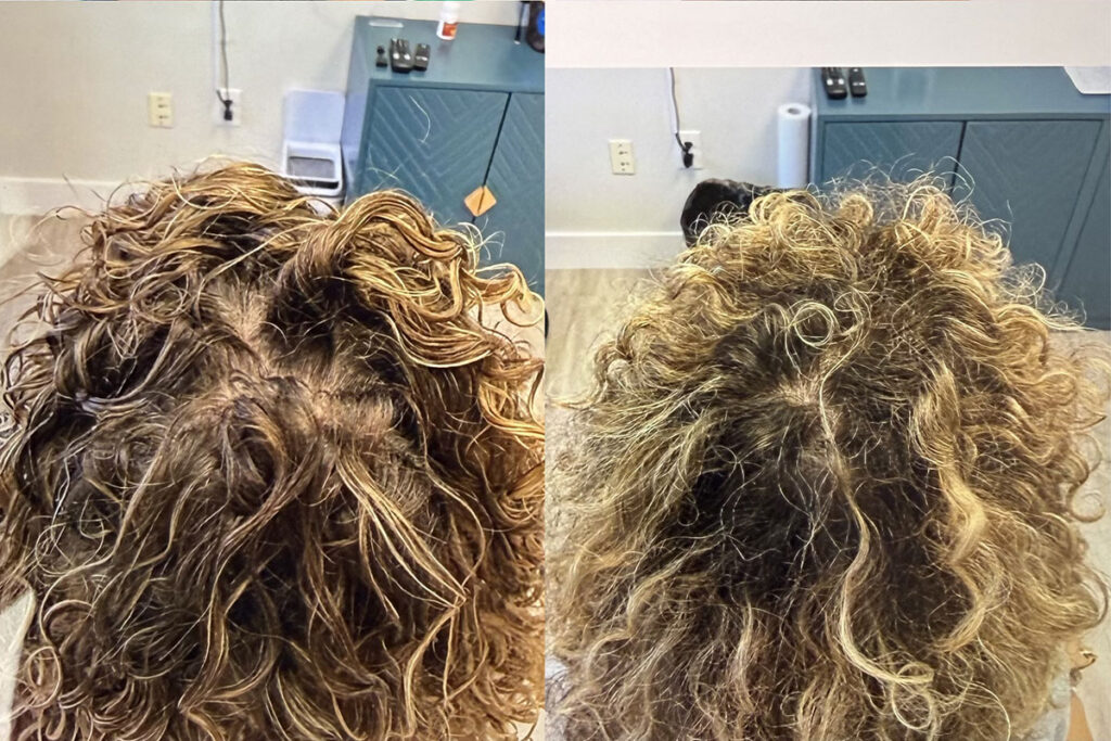 Regenicel Aesthetics Before & After